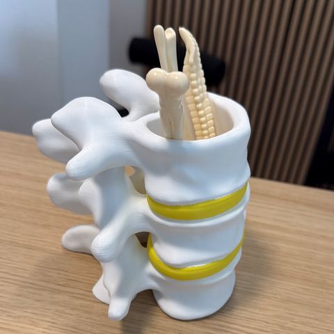Anatomisches Wirbelsäulen-Modell mit Bandscheiben und Spinalnerven in der Physioteam Mühlberg Praxis Altstadt